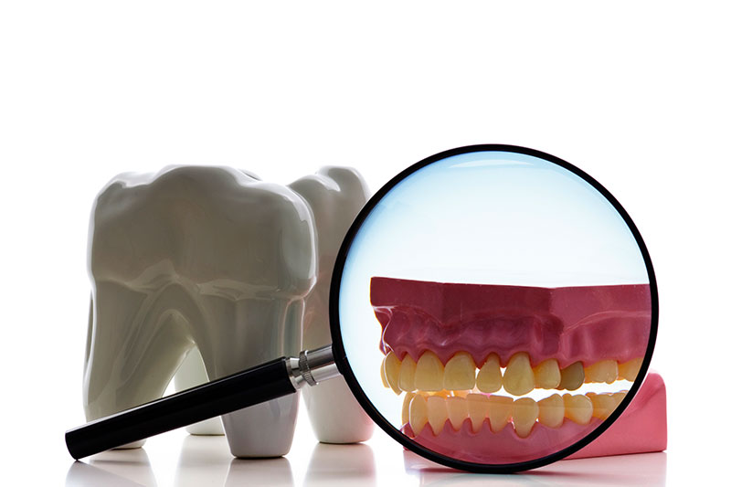 Root Canal Treatment in Mesquite