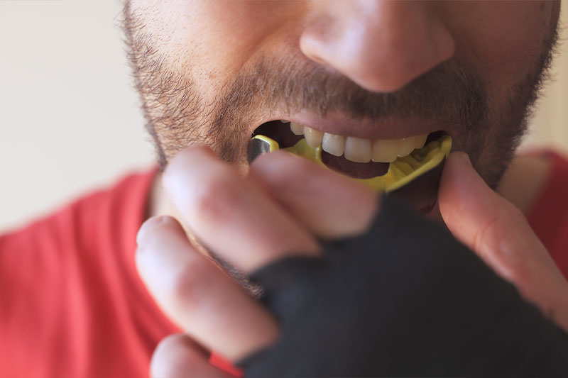 Custom Mouthguards in Mesquite