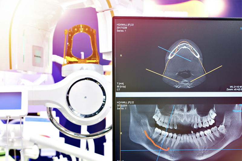 Digital X-Rays in Mesquite